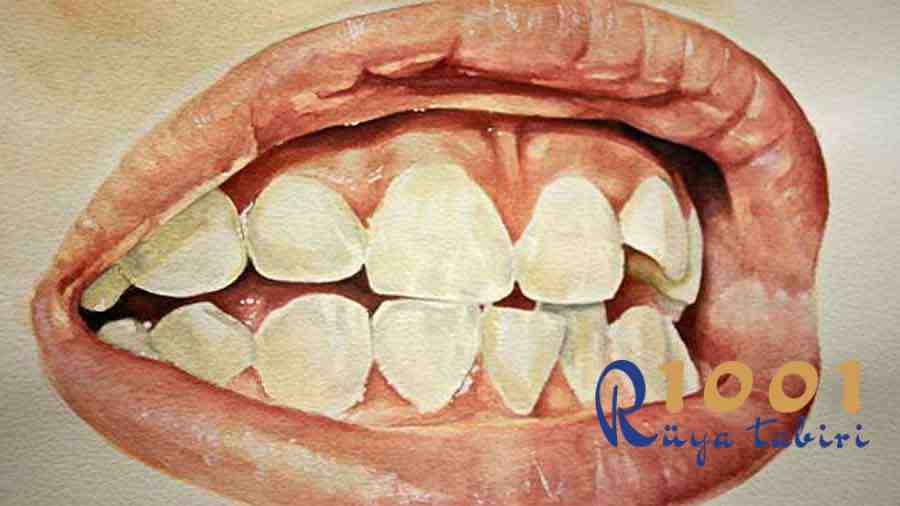 Rüyada Diş Görmek, Rüyada Diş Kırılması, Diş Çıkması - 1001RuyaTabiri.com